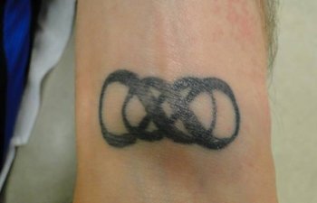 tattoo on a wrist before removal